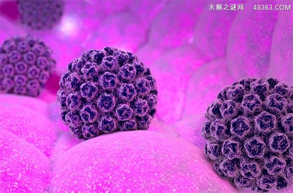 hpv是什么病怎么得的