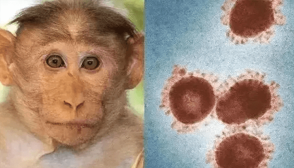 猴痘是什么病有什么症状