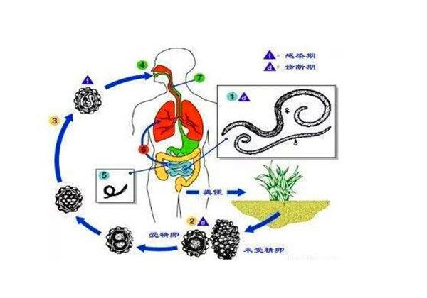 蛔虫和蛲虫有什么症状