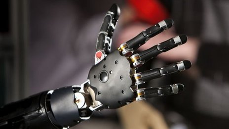 美国约翰-霍普金斯大学应用物理学实验室研制的模块化假肢是世界上最先进的仿生手臂之一。