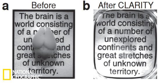 通过“CLARITY”变形技术，小鼠的大脑(左)可以变成透明，但仍然完好的状态(右)。