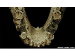 研究发现人类在180万年前就使用牙签