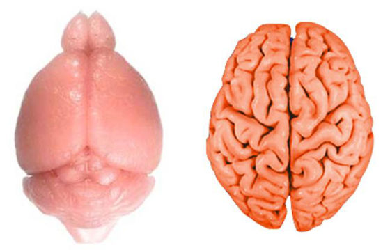 相较于鼠脑(左)，人脑拥有大量沟回。