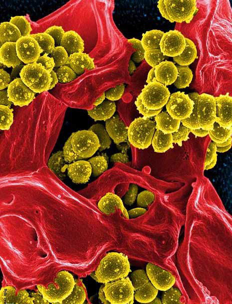 　恐怖的超级细菌每年可杀死1000万人