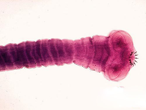 十大最恶心的寄生虫：人体常见寄生虫