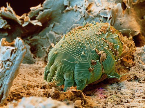 十大最恶心的寄生虫：人体常见寄生虫