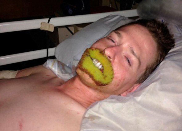 世界上最恶心的人