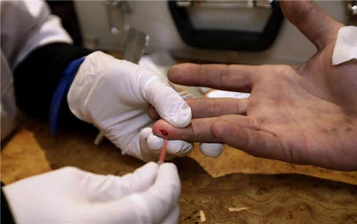 科学家“拍下”艾滋病毒“内应”三维照
