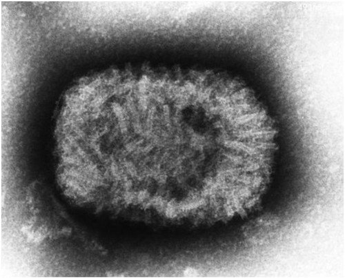 人类历史上12种最致命病毒,冠状病毒上榜