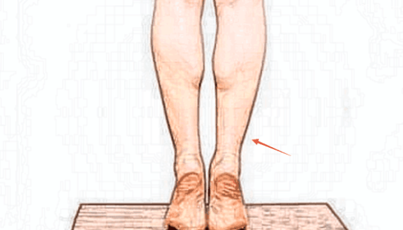如何纠正腿型