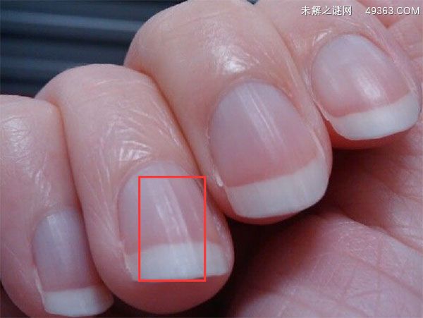 指甲有竖纹是身体的什么信号,有竖纹该如何调理？