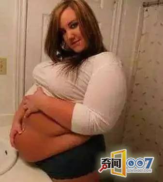 美国女孩生来3只大小一样的胃
