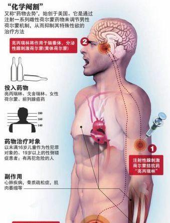 化学阉割