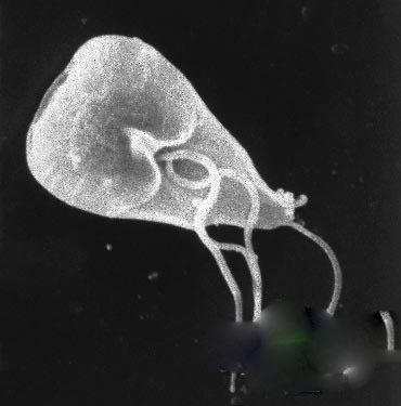 十大最恶心的寄生虫:人体常见寄生虫