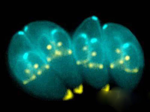 十大最恶心的寄生虫:人体常见寄生虫
