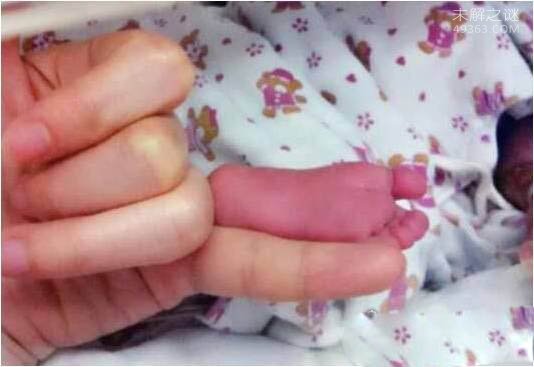 世界上最小的婴儿阿米利娅·泰勒(49363.com)