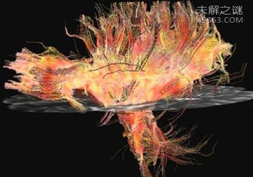 感觉燃烧——热感受器